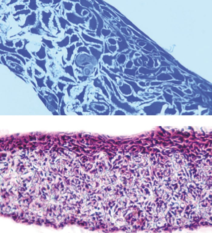 Cells grown in Alvetex Scaffold can be fixed and processed for histological analysis using standard methods.