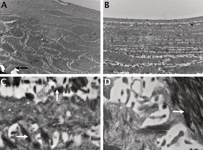 TEM image of keratinocytes cultured at air-liquid interface without collagen or fibroblasts for 14 days.