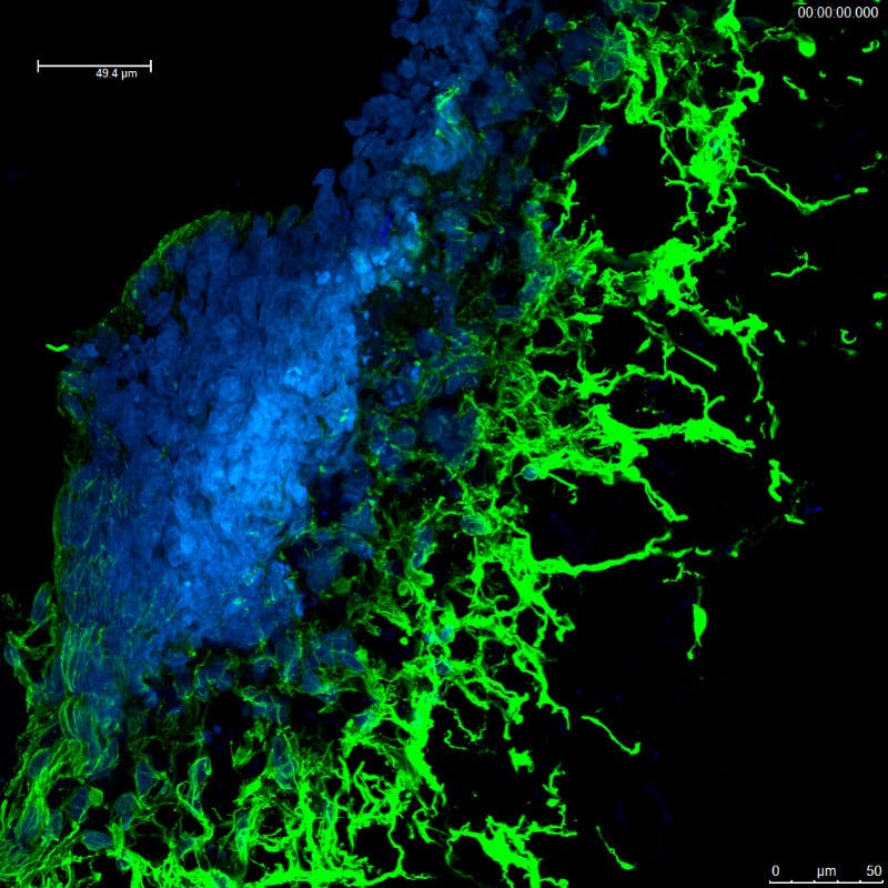 alvetex-science-neurite-outgrowth