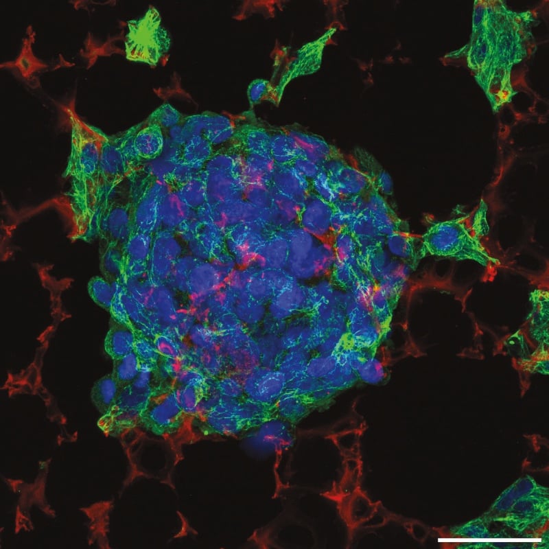 Alvetex Science -- triple confocal microscope image of Hepg2 grown in ALvetex Scaffold