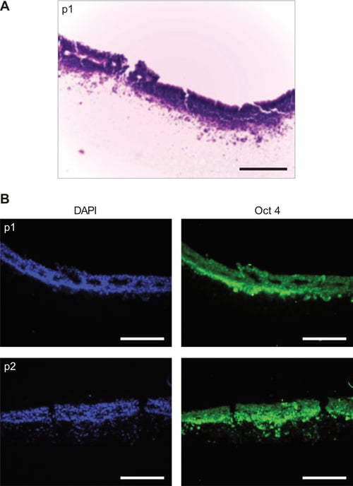 Propagation of human embryonic stem cells (clone RC-10) on Alvetex Strata.