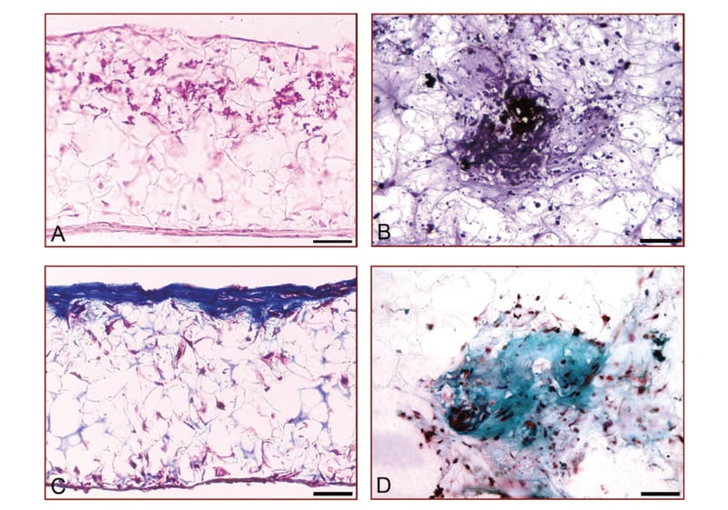 Deposition of calcium and collagen by rat MSCs differentiating into bone in 3D culture using Alvetex Scaffold.