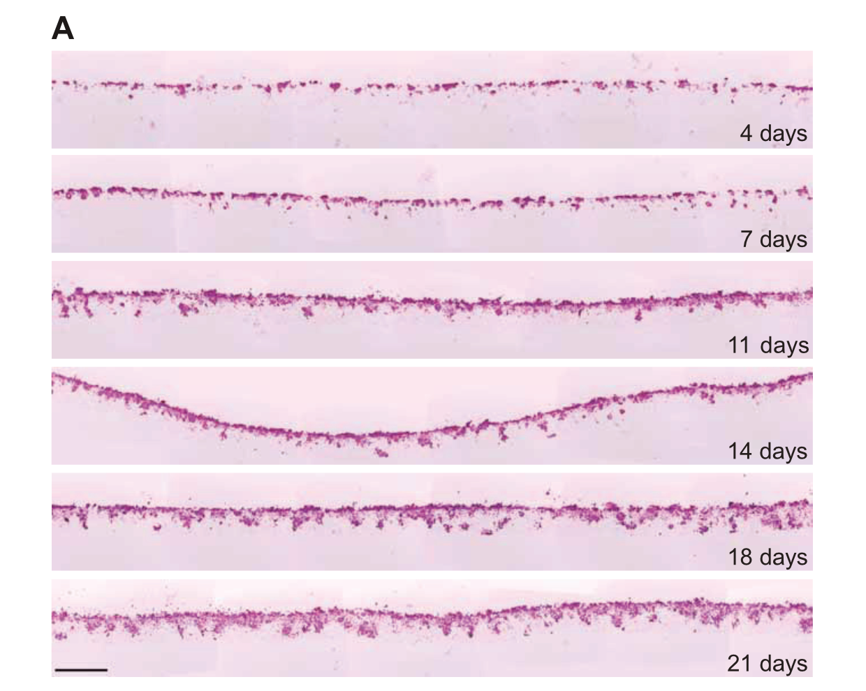 Modelling Cancer Cell Migration and Invasion in Alvetex 3D cell culture