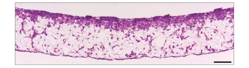 SW480 colon cancer cell invasion into Alvetex Scaffold containing 3T3 fibroblasts.