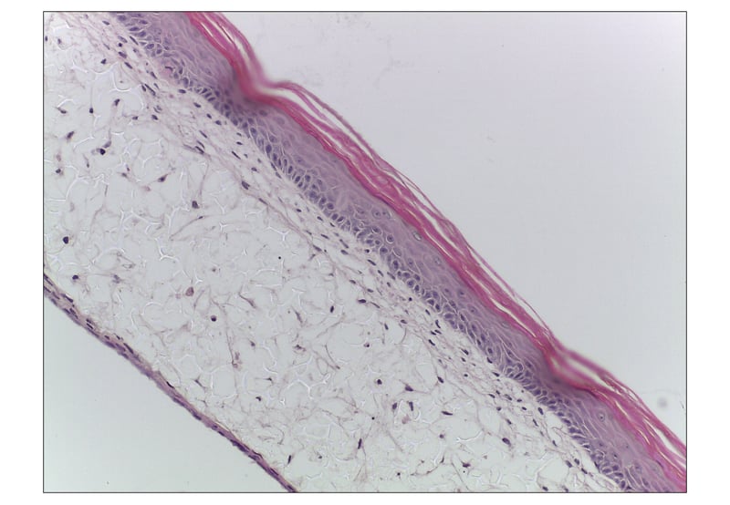 Fully-developed primary human skin equivalent using Alvetex Scaffold.