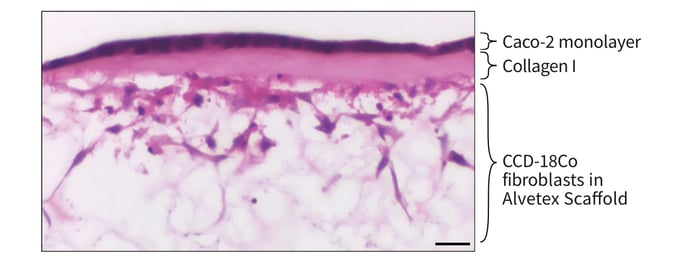 Co-culture of Caco-2 cells and CCD-18Co fibroblasts separated by a collagen I layer in Alvetex Scaffold.