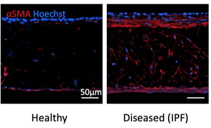 Bioengineered 3D Human Tissue Models & Cell Culture Solutions