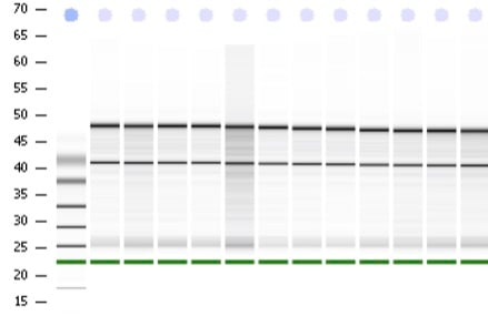 bioanalyzer-analysis-1-1