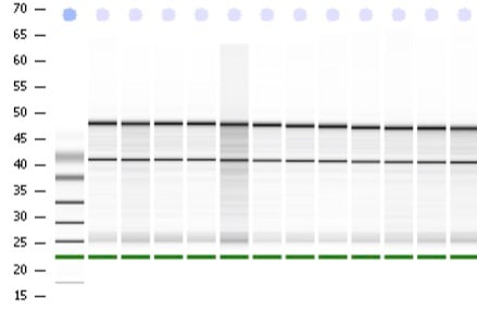 bioanalyzer-analysis-1-1