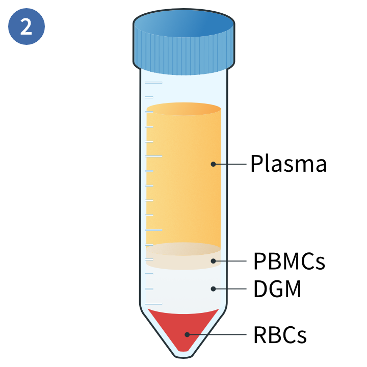 Whole blood plus density gradient
            media