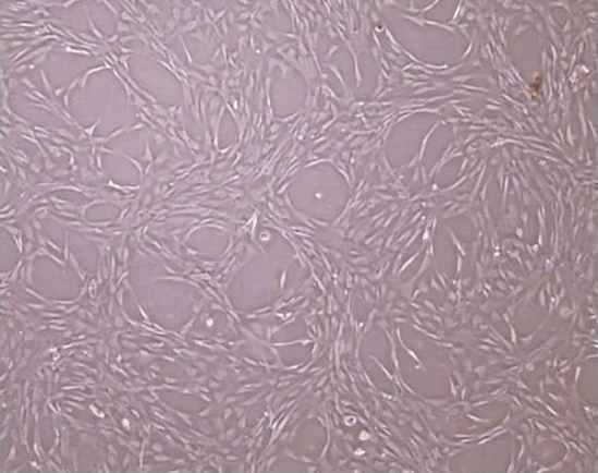 Cellcolabs ready-to-use GMP MSCs