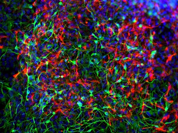 image showing stained ISPCs under a microscope