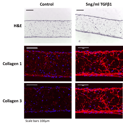 collagen-deposition-and-inhibition-in-alvetex-skin-model