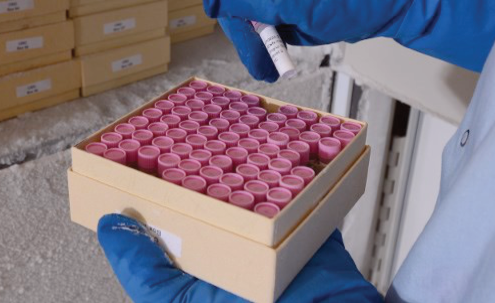 REPROCELL human tissue samples in an ultra deep freezer