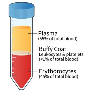 diluted-blood-dgm-centrifuged-1