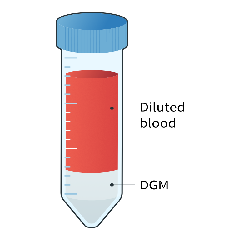 Whole blood plus density gradient media