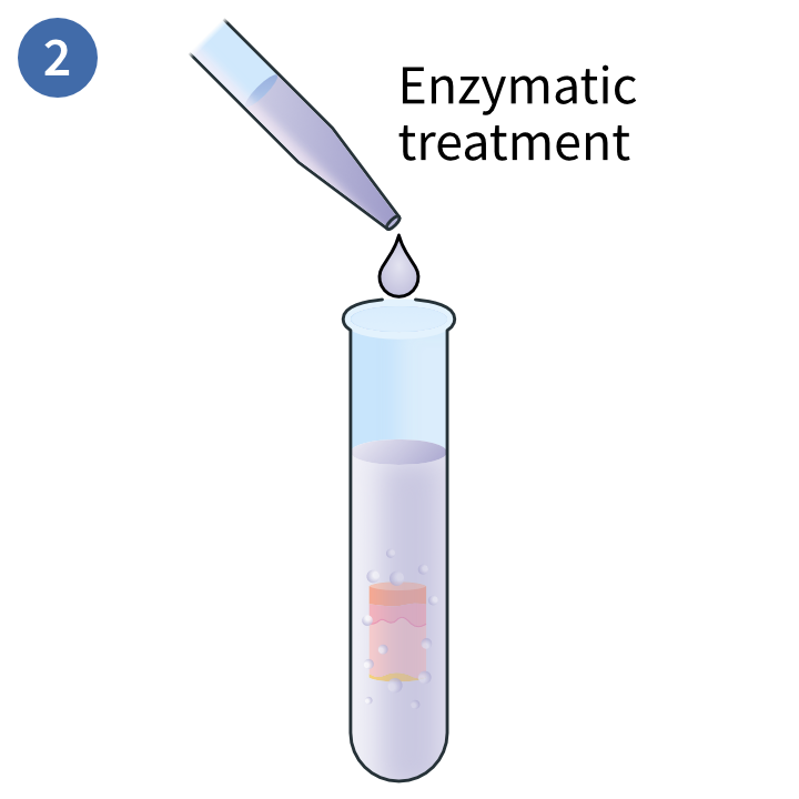 Enzymatic digestion of skin tissue