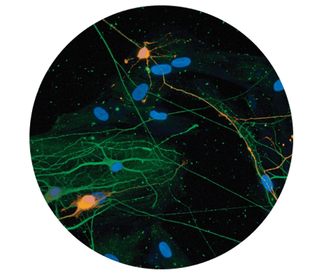 SynFire hiPSC human Neurons stained using ICC