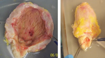 Genitourinary assays