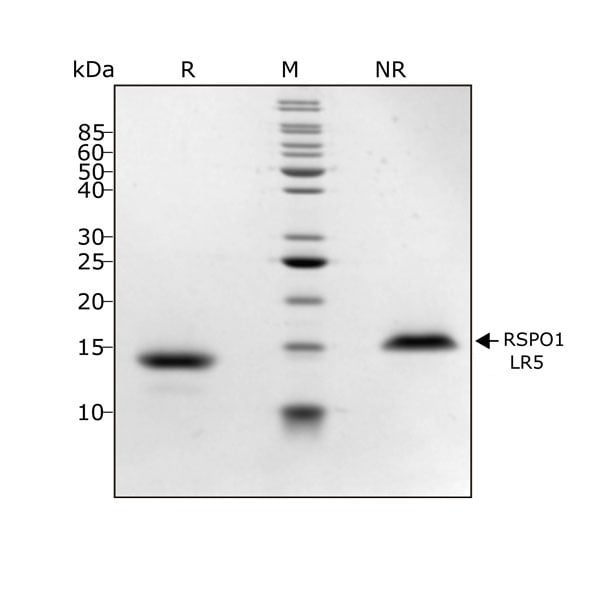 human-R-spondin-1-LR5-Qk031-protein-purity-lot-104286