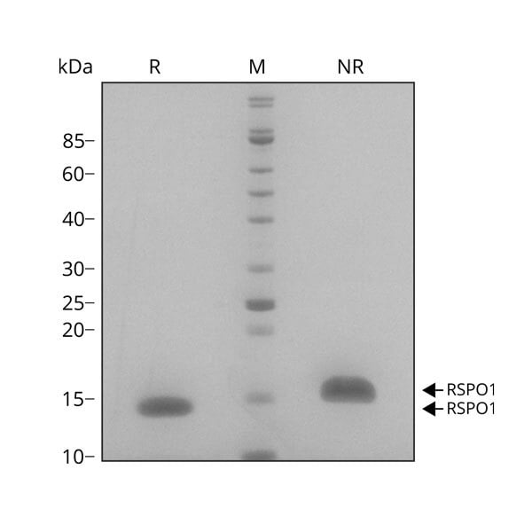 human-R-spondin-1-Qk006-protein-purity-lot-010