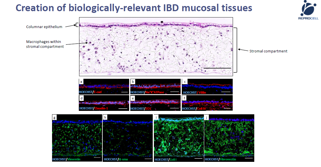 Revolutionizing IBD Research with Innovative In Vitro Models