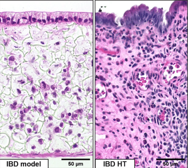 Revolutionizing IBD Research with Innovative In Vitro Models
