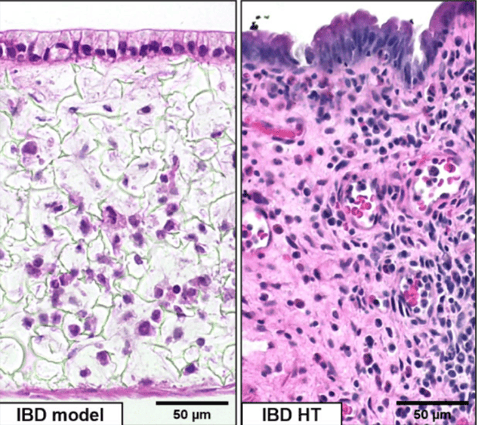 Revolutionizing IBD Research with Innovative In Vitro Models