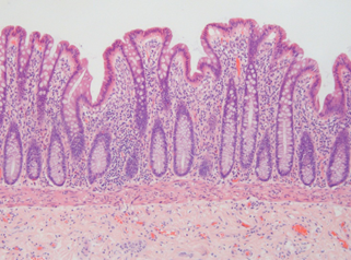 A microscope image of a healthy intestinal epithelium