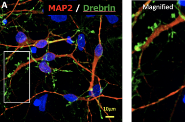 Images of neurons under a fluorescent microscope