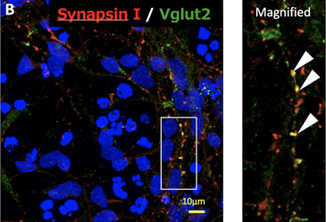 Images of neurons under a fluorescent microscope