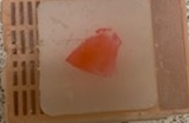 FFPE block