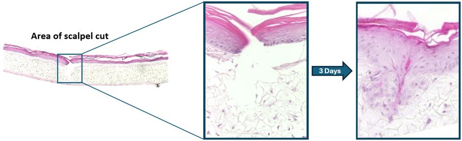 A cut is created in the epidermis alone
