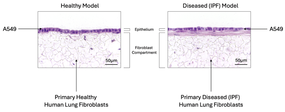 DD assay 130 - pulmonary interstitial compartment - IPF-derived human lung fibroblasts