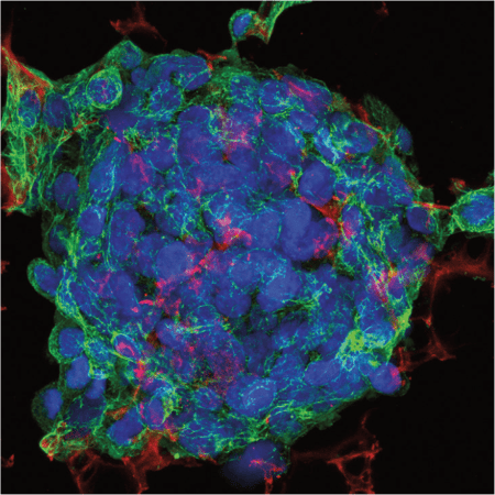 HepG2 cells grown on Alvetex Scaffold