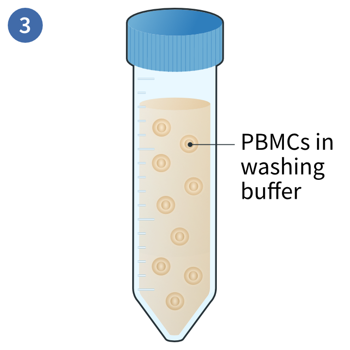 Whole blood plus density gradient
media