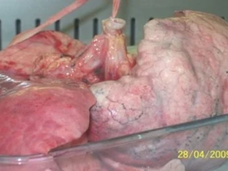 Multiple human lung parenchymal 3-5mm3 explants dissected from diseased COPD lung tissue 