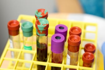 Plasma or Serum? – You Decide