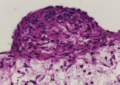 Neuronal assays