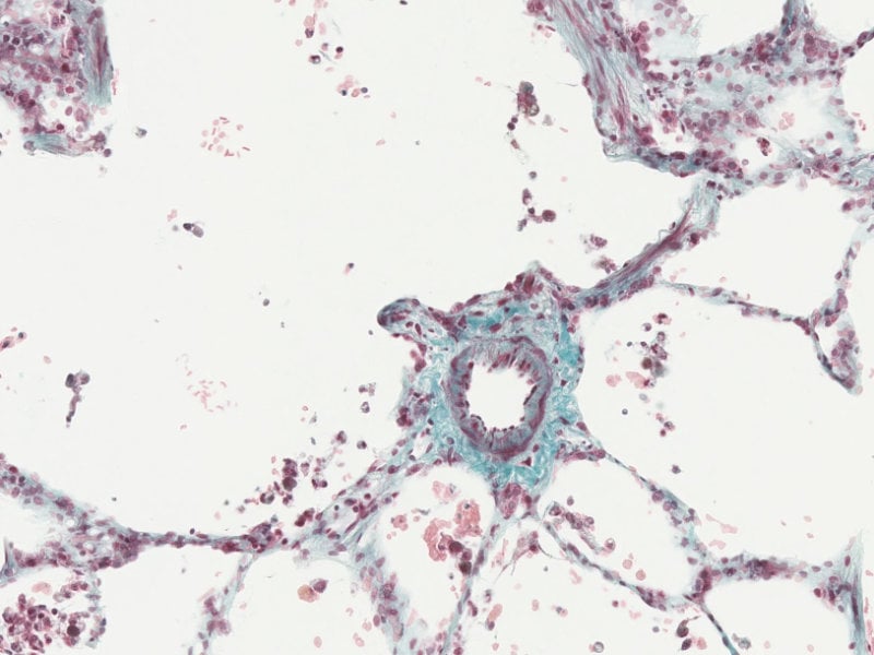 Precision-cut lung slice 