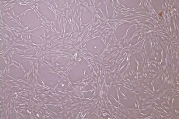 ready-to-use-gmp-msc-cell-culture.jpg