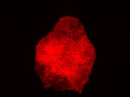 TdTomato iPSC