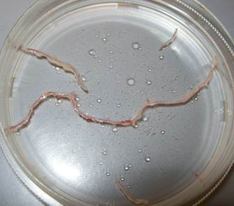 Subcutaneous resistance arteries 
