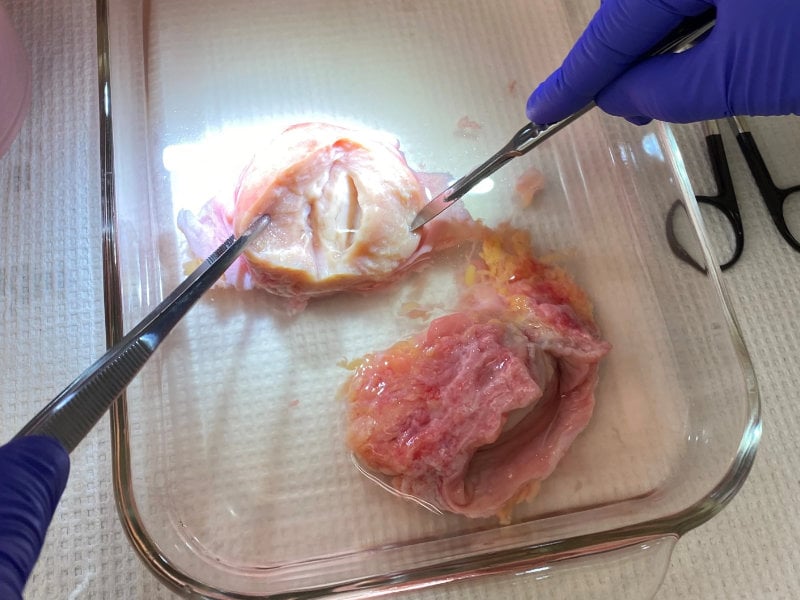 Uterine Contractility 
