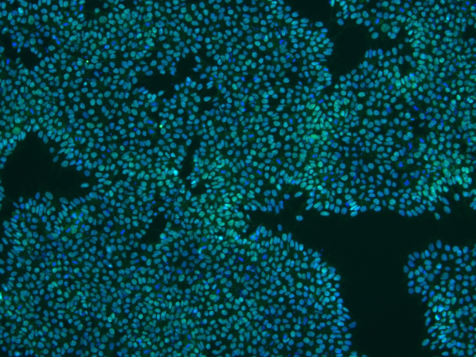 iPS cells stained GFP