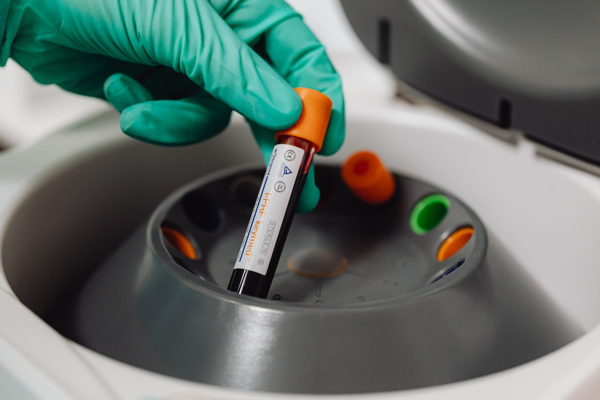How to isolate PBMCs from whole blood using density gradient centrifugation