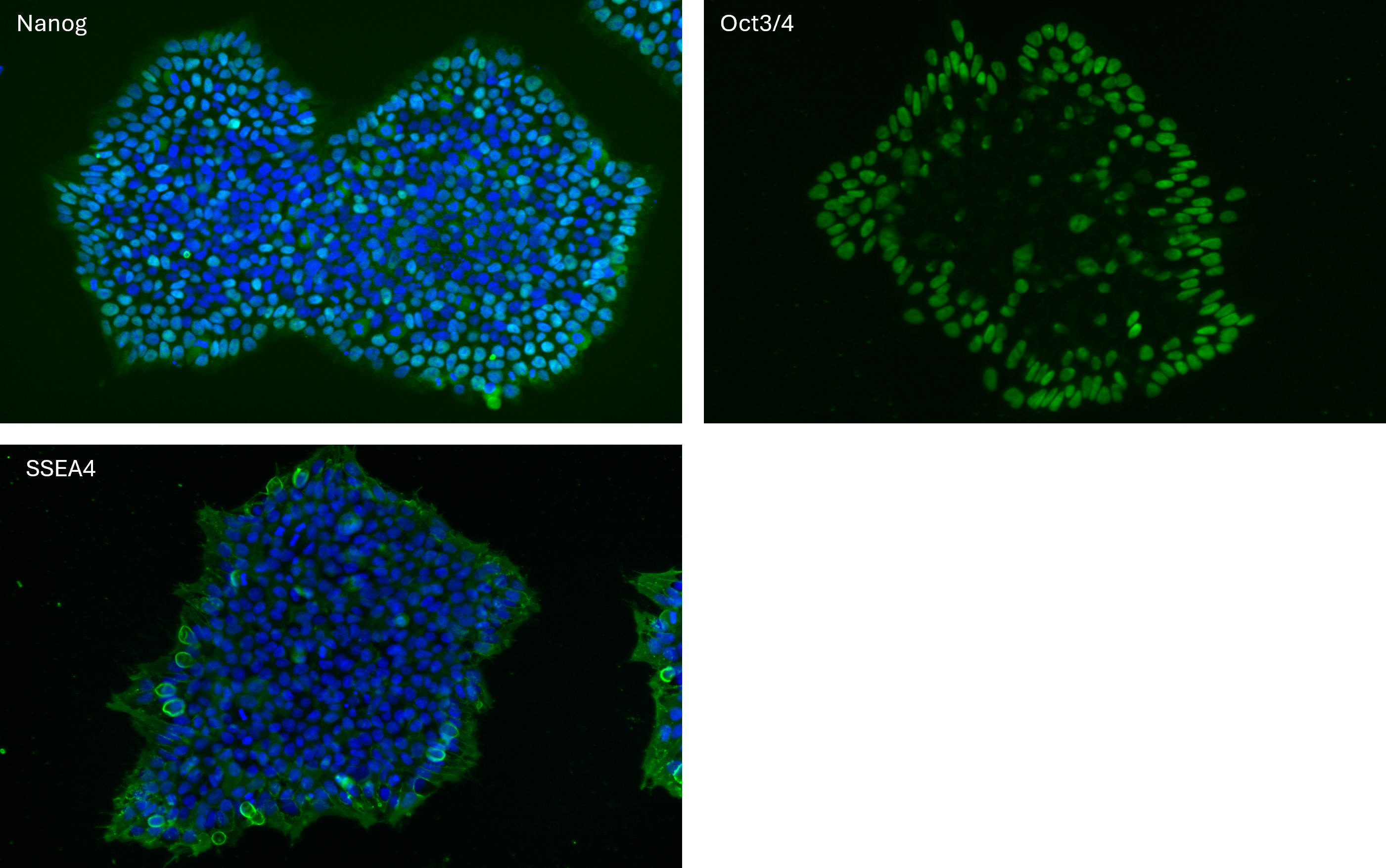 B2M KO pluripotency markers expression