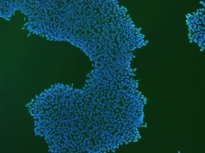 Stem cells stained for OCT4 and DAPI