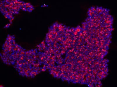 Stem cells stained for SSEA4 and DAPI