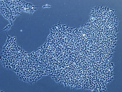 iPSC under phase contrast microscopy